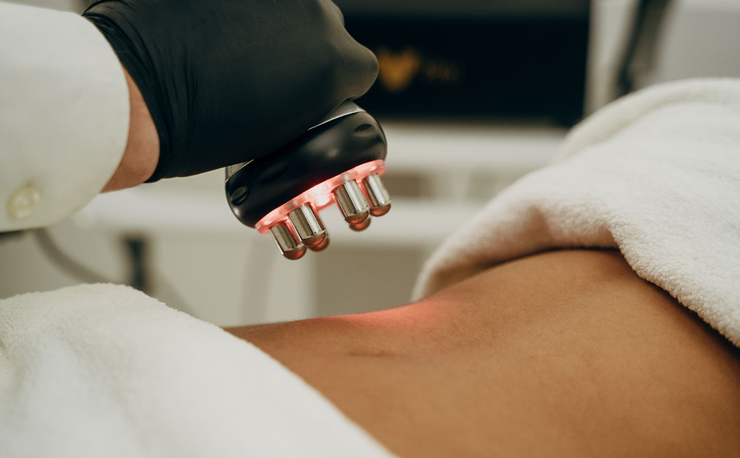 Radiotalasni lifting Borča